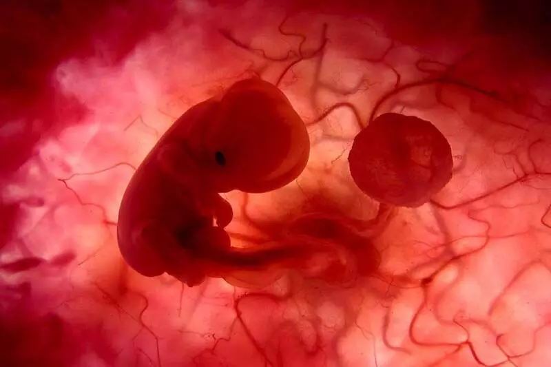 abortion-rights-in-turkey